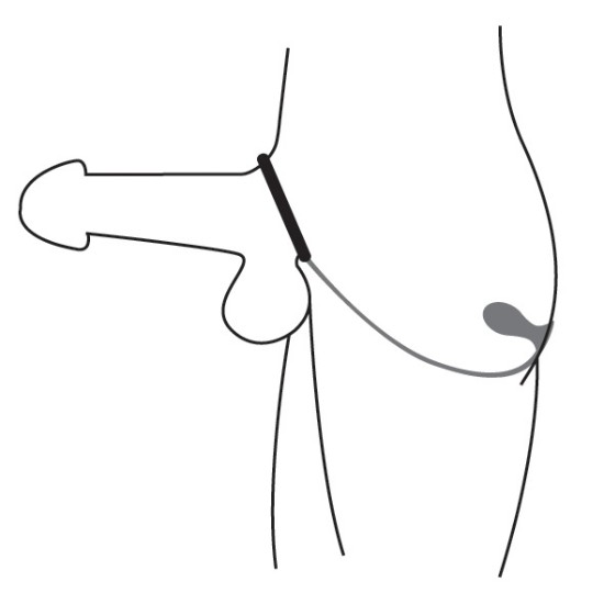 Picture of Rover Silicone Cock Ring and Prostate Plug