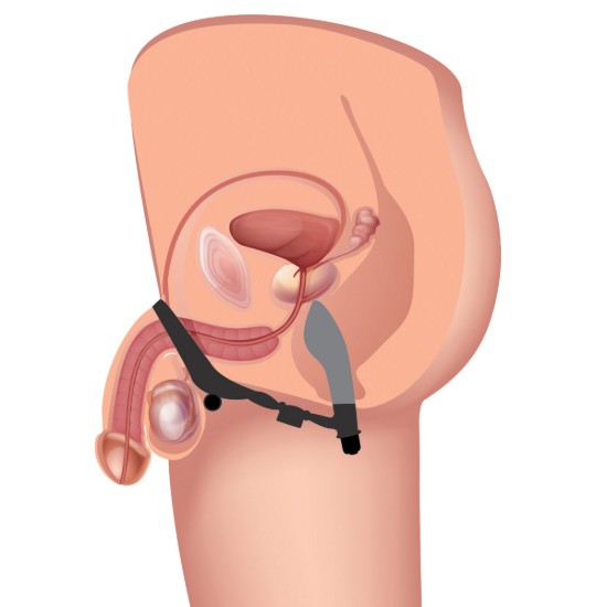 Picture of Epic Triple Stim Anal Plug and Cock Ring