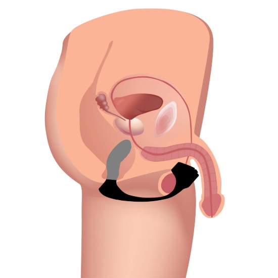 Picture of 7X Silicone Prostate Plug with Ball Stretcher and Remote