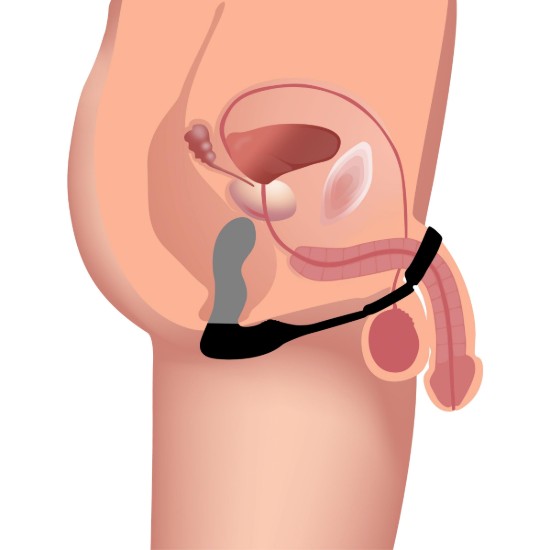 Picture of 10X Inflatable and Vibrating Prostate Plug with Cock and Ball Ring