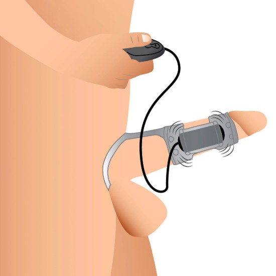 Picture of 20X Dual Cock Teaser with Cock and Ball Ring