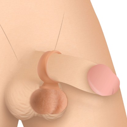 Picture of 28X Vibrating Realistic Balls with Remote - 40mm